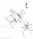 Fig. 07 - Catheter sheath slitter and method of use