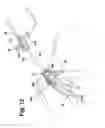 Fig. 09 - Catheter sheath slitter and method of use