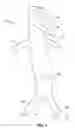 Fig. 02 - Method and apparatus for intra aortic substance delivery to a branch vessel