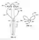 Fig. 09 - Method and apparatus for intra aortic substance delivery to a branch vessel