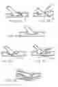 Fig. 09 - Method and apparatus for performing minimally invasive cardiac procedures