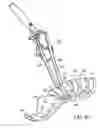 Fig. 04 - Method and apparatus for artificial disc insertion