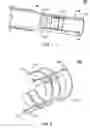 Fig. 02 - Apparatus and method for elongation of a papillary muscle
