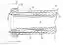 Fig. 01 - Device and method for performing end-to-side anastomosis