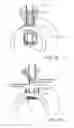 Fig. 06 - Device and method for performing end-to-side anastomosis