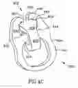 Fig. 07 - Anastomotic connectors