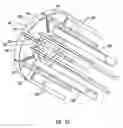 Fig. 09 - Methods for forming an anastomosis opening in a side of a blood vessel