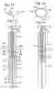 Fig. 06 - Minimal access lumbar diskectomy instrumentation and method