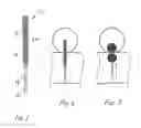 Fig. 02 - Aneurysm repair method and apparatus