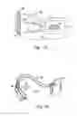 Fig. 02 - Devices for adapting charge initiation for an implantable cardioverter-defibrillator