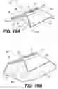 Fig. 08 - Spinal disc annulus reconstruction method and deformable spinal disc annulus stent