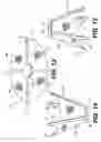 Fig. 11 - Spinal disc annulus reconstruction method and deformable spinal disc annulus stent