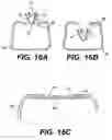 Fig. 12 - Spinal disc annulus reconstruction method and deformable spinal disc annulus stent