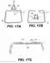 Fig. 13 - Spinal disc annulus reconstruction method and deformable spinal disc annulus stent