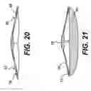 Fig. 15 - Spinal disc annulus reconstruction method and deformable spinal disc annulus stent
