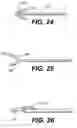 Fig. 17 - Spinal disc annulus reconstruction method and deformable spinal disc annulus stent