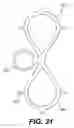 Fig. 20 - Spinal disc annulus reconstruction method and deformable spinal disc annulus stent