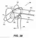Fig. 27 - Spinal disc annulus reconstruction method and deformable spinal disc annulus stent