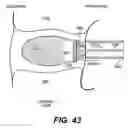 Fig. 32 - Spinal disc annulus reconstruction method and deformable spinal disc annulus stent