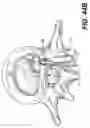 Fig. 34 - Spinal disc annulus reconstruction method and deformable spinal disc annulus stent