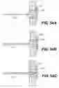 Fig. 57 - Spinal disc annulus reconstruction method and deformable spinal disc annulus stent