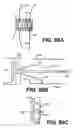 Fig. 61 - Spinal disc annulus reconstruction method and deformable spinal disc annulus stent