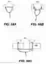 Fig. 63 - Spinal disc annulus reconstruction method and deformable spinal disc annulus stent