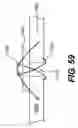 Fig. 64 - Spinal disc annulus reconstruction method and deformable spinal disc annulus stent