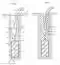 Fig. 02 - Activated stemming device