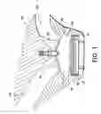 Fig. 02 - High compression pistons having vanes or channels