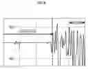 Fig. 06 - Sleep stage determination apparatus