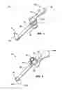 Fig. 02 - Cap for vessel for performing multi-stage process