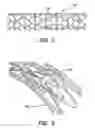Fig. 02 - Method and system for coating a medical device using optical drop volume verification