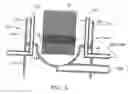 Fig. 07 - Membrane filtration module with adjustable header spacing