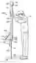 Fig. 01 - Apparatus and method for supporting roll-up safety fencing