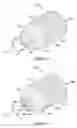 Fig. 02 - User disposable member for use within the ear canal and methods for manufacturing the same
