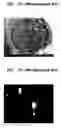 Fig. 06 - Field emission display device and method of manufacturing the same