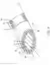 Fig. 09 - Drug-eluting biodegradable stent