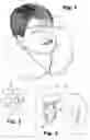 Fig. 02 - Moisture and lotion retainer