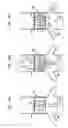Fig. 08 - Extracardiac blood flow amplification device