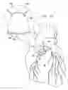 Fig. 10 - Extracardiac blood flow amplification device