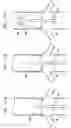 Fig. 11 - Extracardiac blood flow amplification device