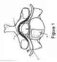 Fig. 02 - Nerve protection barrier
