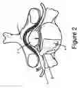 Fig. 03 - Nerve protection barrier