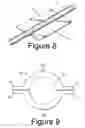 Fig. 09 - Nerve protection barrier