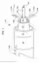 Fig. 02 - Devices and methods for treating aortic valve stenosis