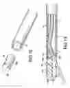 Fig. 09 - Treatment tool for endoscope