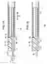 Fig. 10 - Treatment tool for endoscope