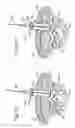 Fig. 09 - Minimal access lumbar diskectomy instrumentation and method