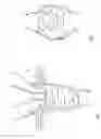 Fig. 02 - Method and device for canulation and occlusion of uterine arteries